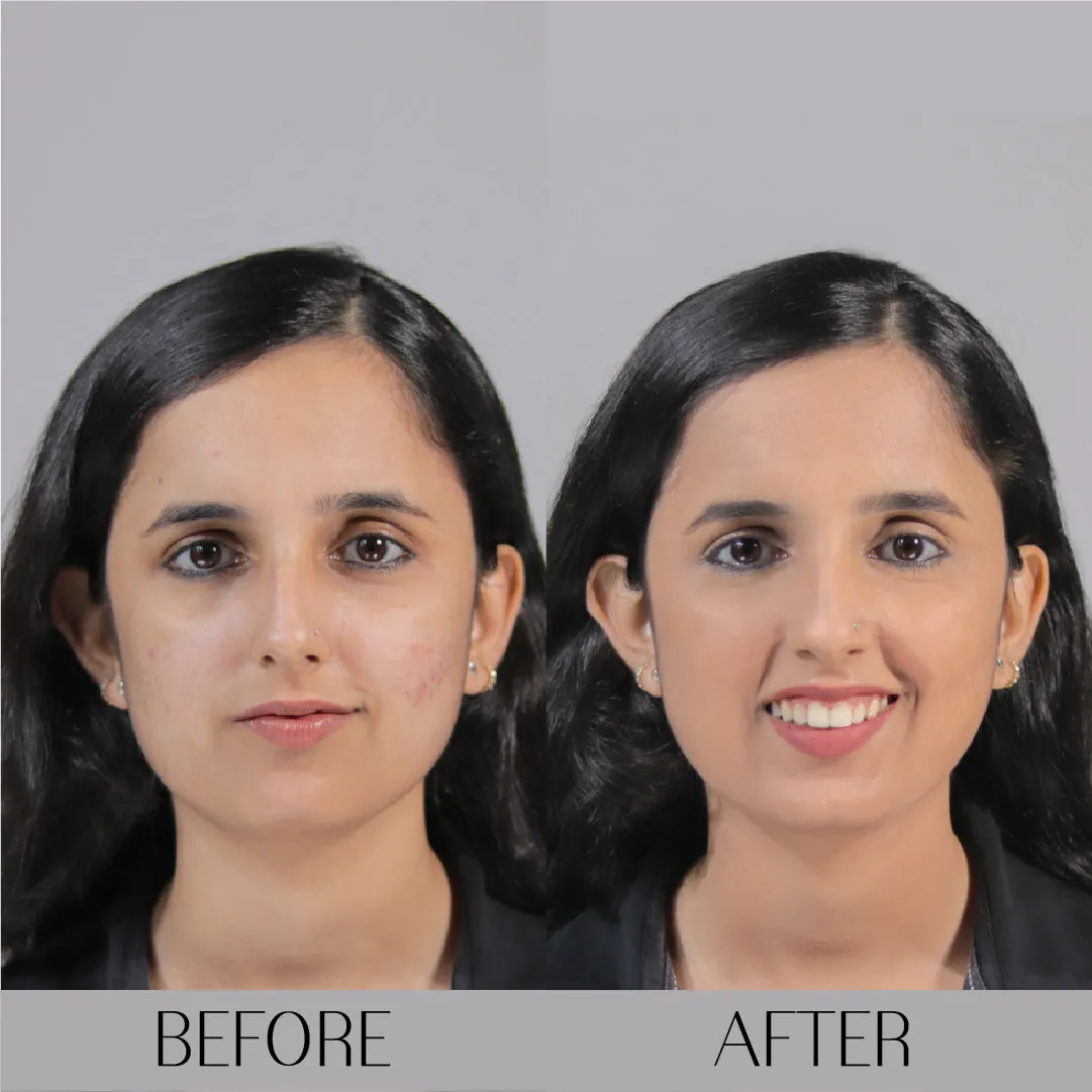 Almond Rom Com- Lights Camera Foundation  4K Matte Finish