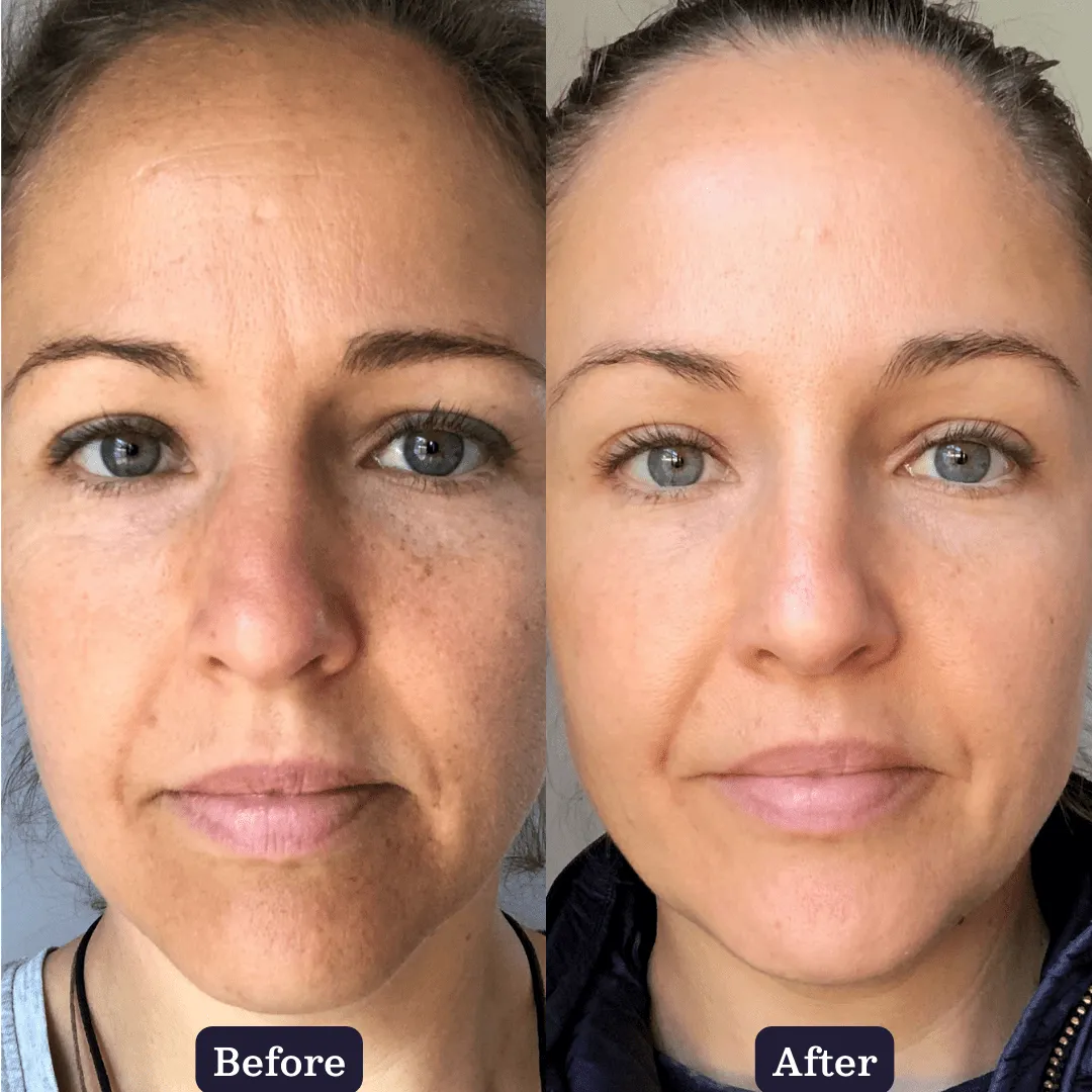 Inside Out Collagen Boosting Duo