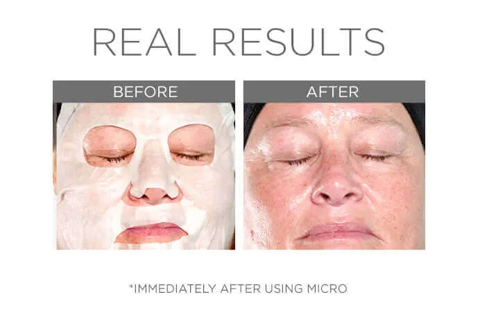 Micro Defense Microbiome Sheet Mask Set, 5-pcs