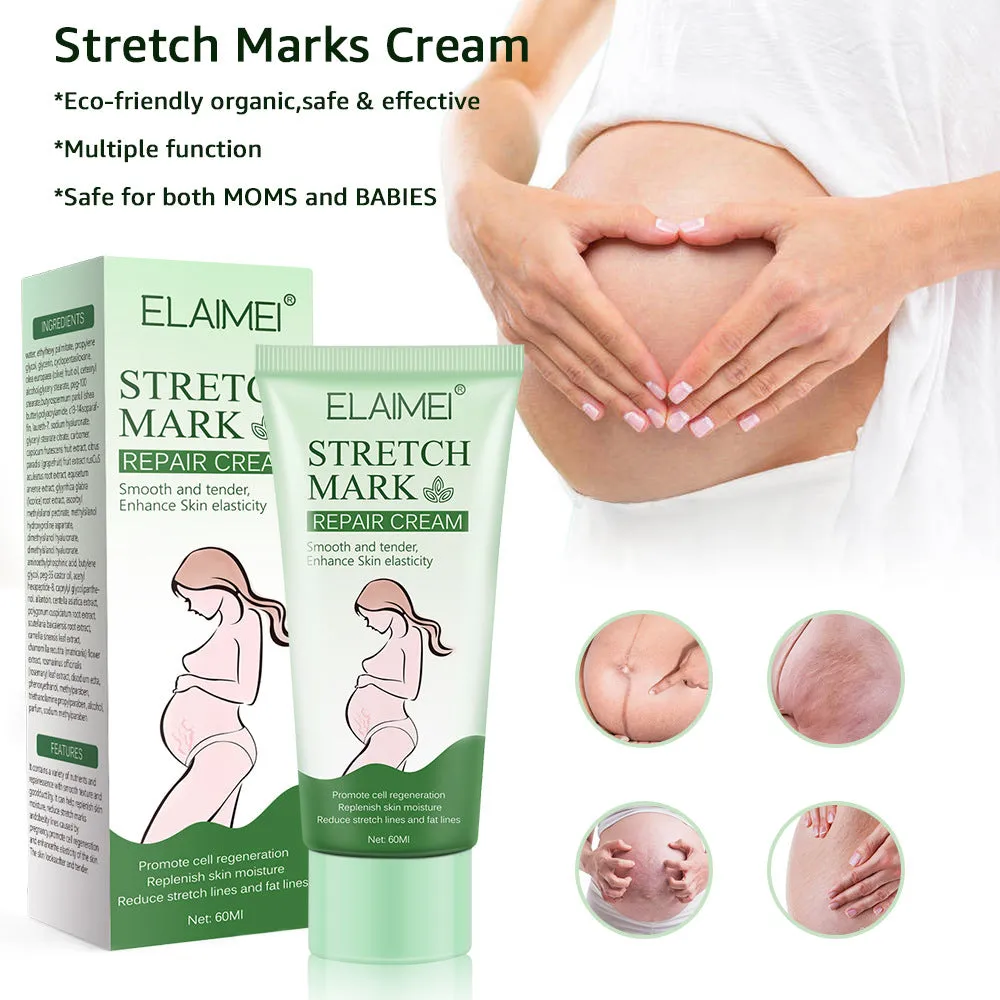 Stretch Mark Repair Cream Smooth Tender Enhance Skin Elastictiy Acne Repair 60ml Anti-Aging Cream Pregnancy Scars