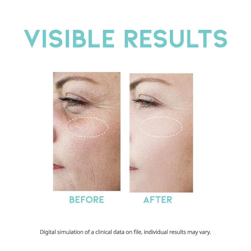 Wrinkle Lift Retinol Serum