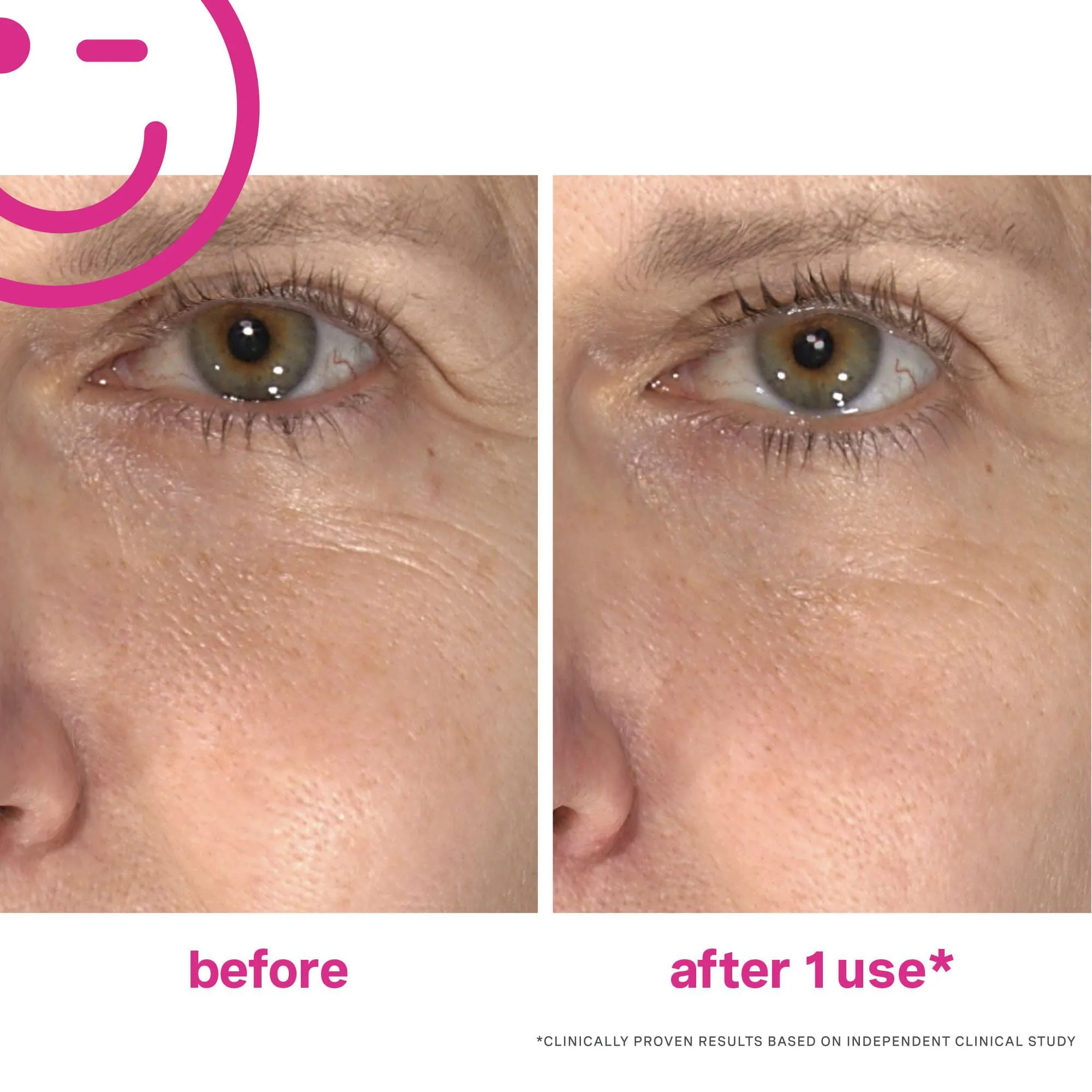 Wrinkle Warrior® 2-in-1 Plumping Moisturizer   Serum